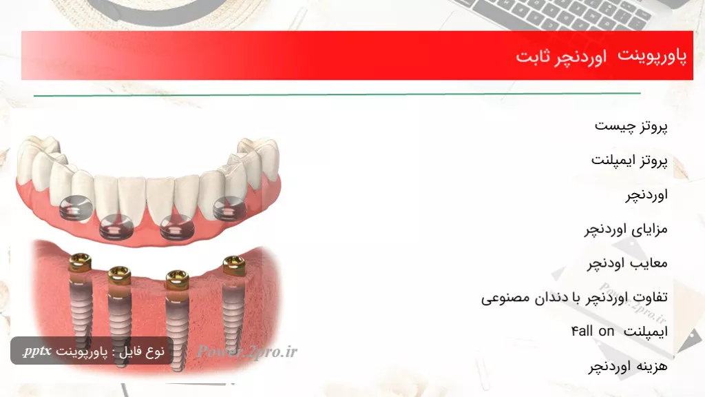 اوردنچر ثابت