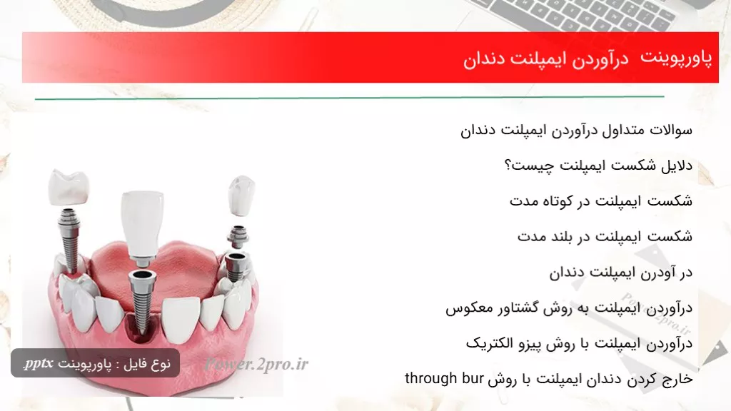 درآوردن ایمپلنت دندان