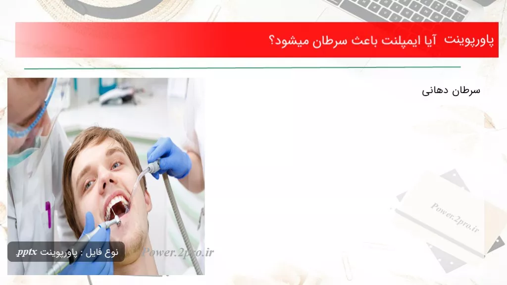 دانلود پاورپوینت آیا ایمپلنت علت سرطان میشود؟ - کد108169