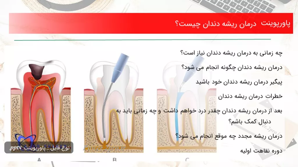 دانلود پاورپوینت درمان ریشه دندان چه چیزی است ؟ - کد108206