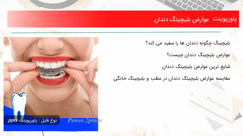 دانلود پاورپوینت عوارض بلیچینگ دندان - کد108218