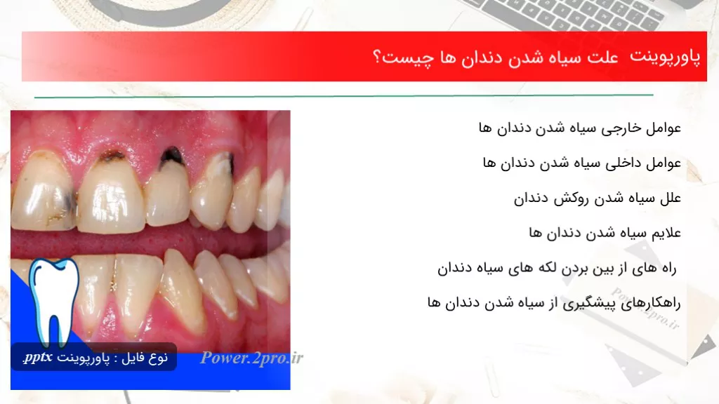 دانلود پاورپوینت چرایی سیاه شدن دندان ها چه چیزی است ؟ - کد108230