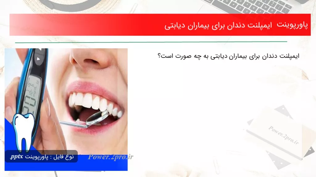 دانلود پاورپوینت ایمپلنت دندان به منظور بیماران دیابتی - کد108267