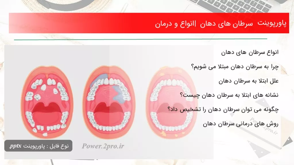 دانلود پاورپوینت سرطان های دهان | انواع و درمان - کد108288