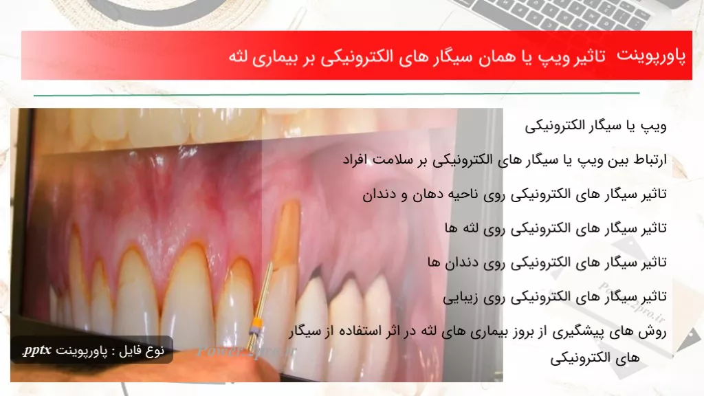 دانلود پاورپوینت اثر ویپ یا همان سیگار های الکترونیکی بر بیماری لثه - کد108292