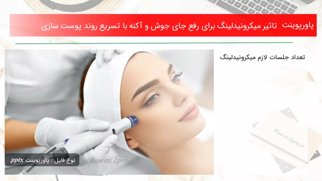 دانلود پاورپوینت اثر میکرونیدلینگ به منظور برطرف جای جوش و آکنه با تسریع روند پوست سازی - کد108422