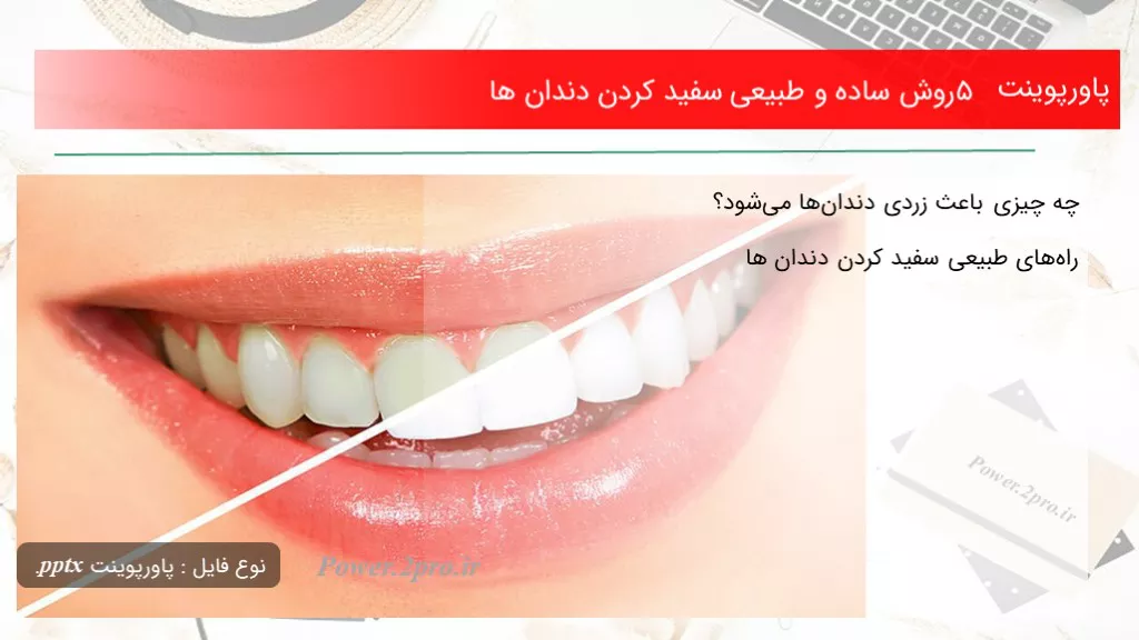 دانلود پاورپوینت ۵ چگونگی ساده و طبیعی سفید کردن دندان ها - کد108711