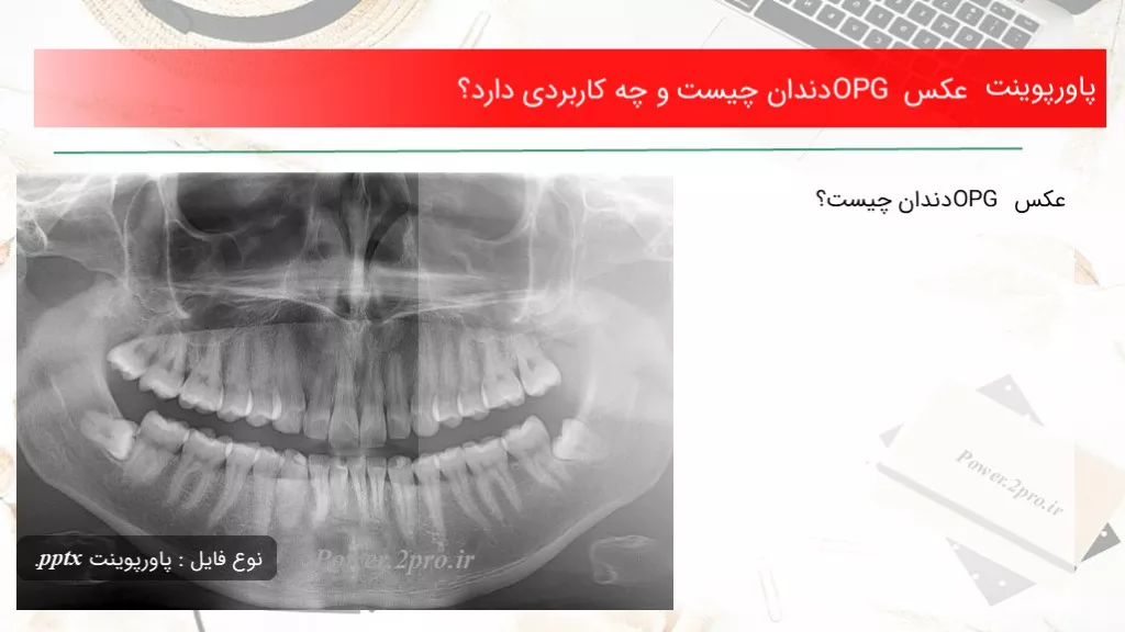 دانلود پاورپوینت عکس OPG دندان چه چیزی است و چه کاربردی دارد؟ - کد108896
