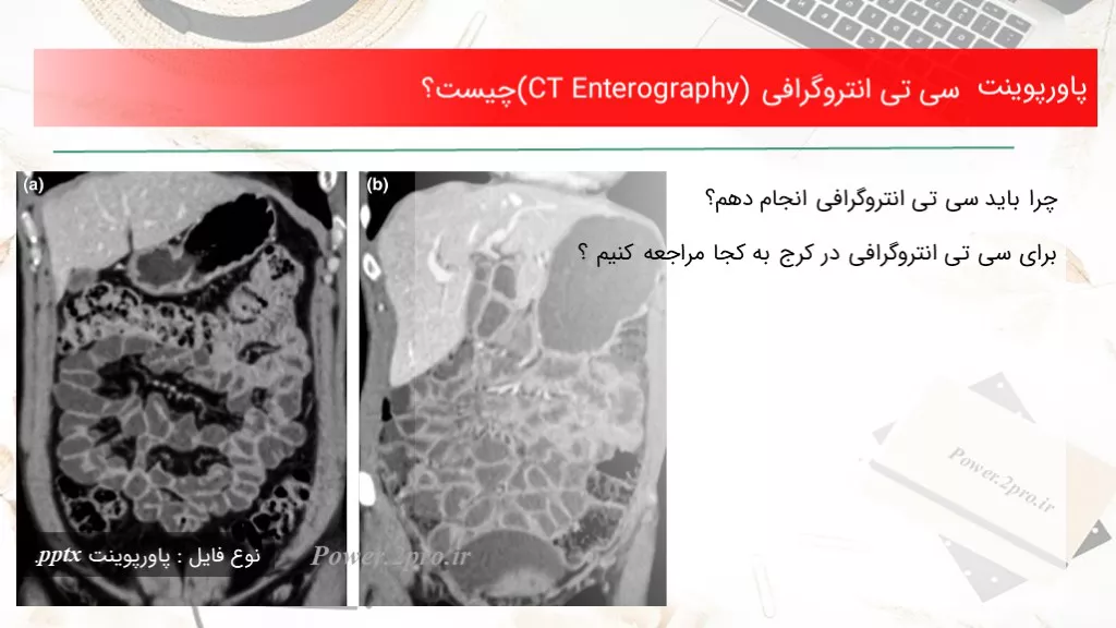 دانلود پاورپوینت سی تی انتروگرافی (CT Enterography) چه چیزی است ؟ - کد108929
