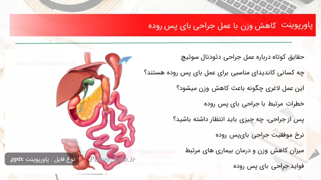 دانلود پاورپوینت افت وزن با عمل جراحی بای پس روده - کد109211