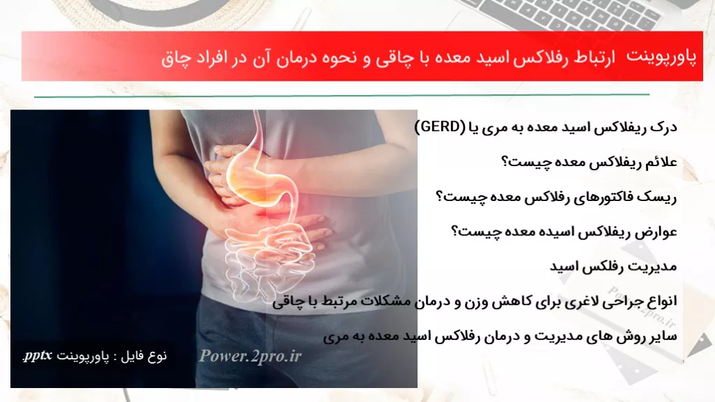 دانلود پاورپوینت بستگی رفلاکس اسید معده با چاقی و نحوه درمان آن در افراد چاق - کد109243