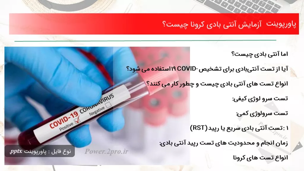 دانلود پاورپوینت آزمایش آنتی بادی کرونا چه چیزی است ؟ - کد109293