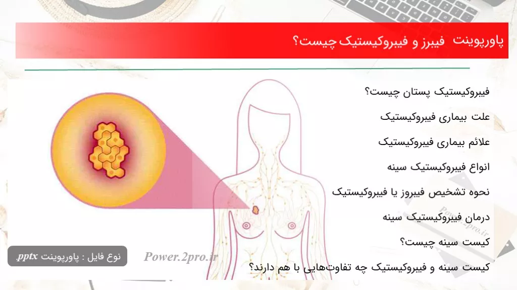 دانلود پاورپوینت فیبرز و فیبروکیستیک چه چیزی است ؟ - کد109342