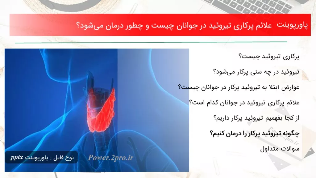 دانلود پاورپوینت علائم پرکاری تیروئید در جوانان چه چیزی است و چگونه درمان می‌شود؟ - کد109620