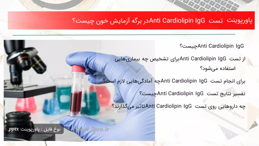 دانلود پاورپوینت تست Anti Cardiolipin IgG در برگه آزمایش خون چه چیزی است ؟ - کد109652