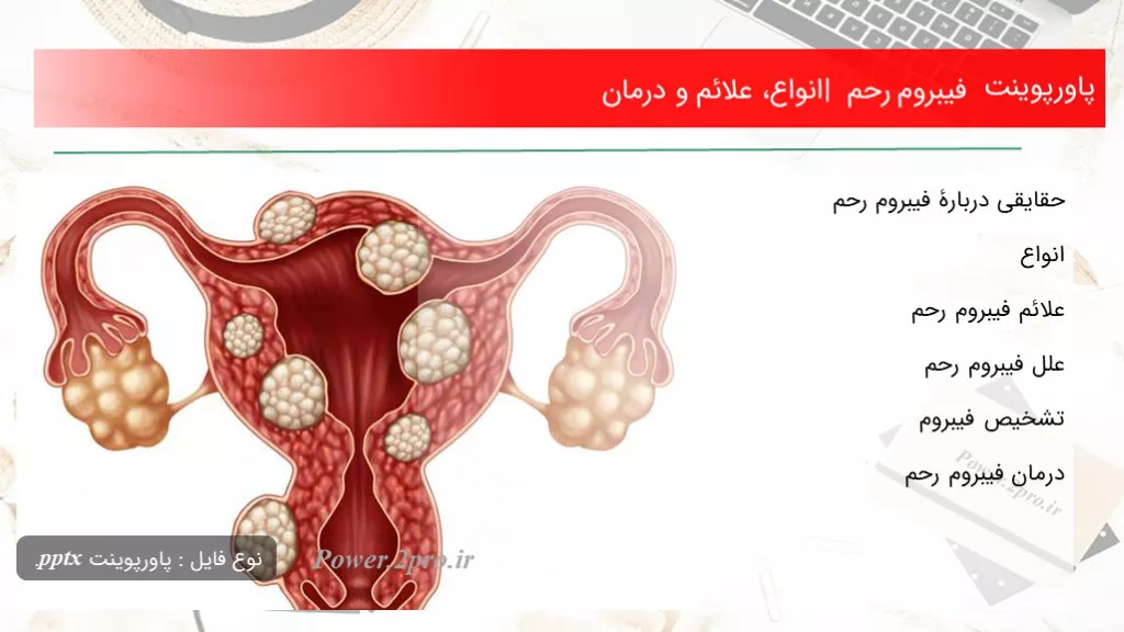 فیبروم رحم 