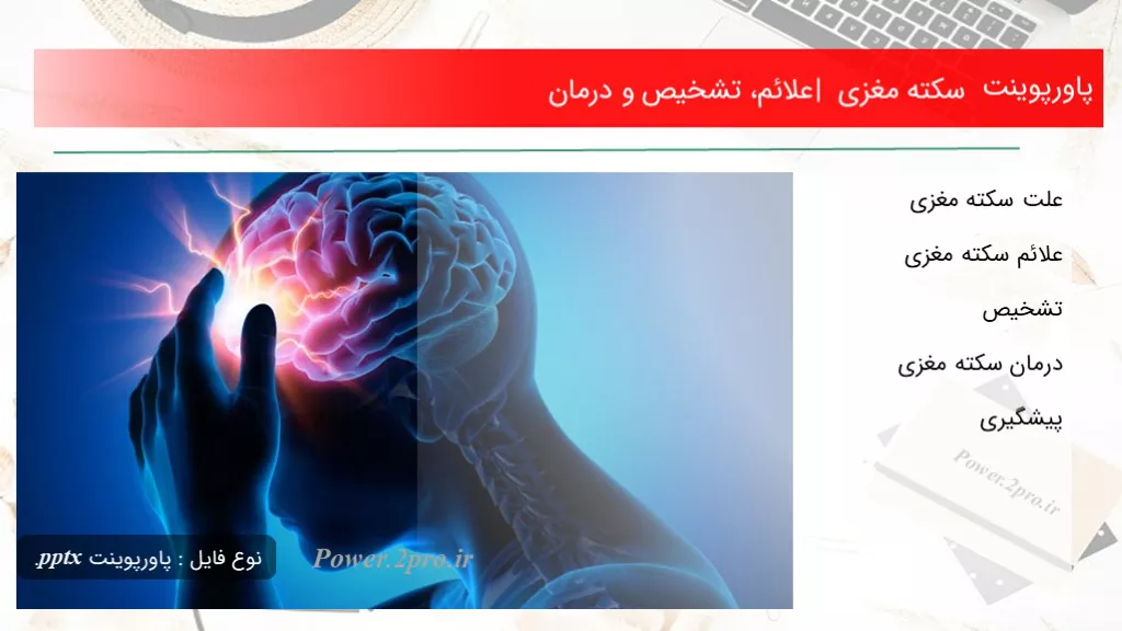 دانلود پاورپوینت سکته مغزی | علائم، تشخیص و درمان - کد109744