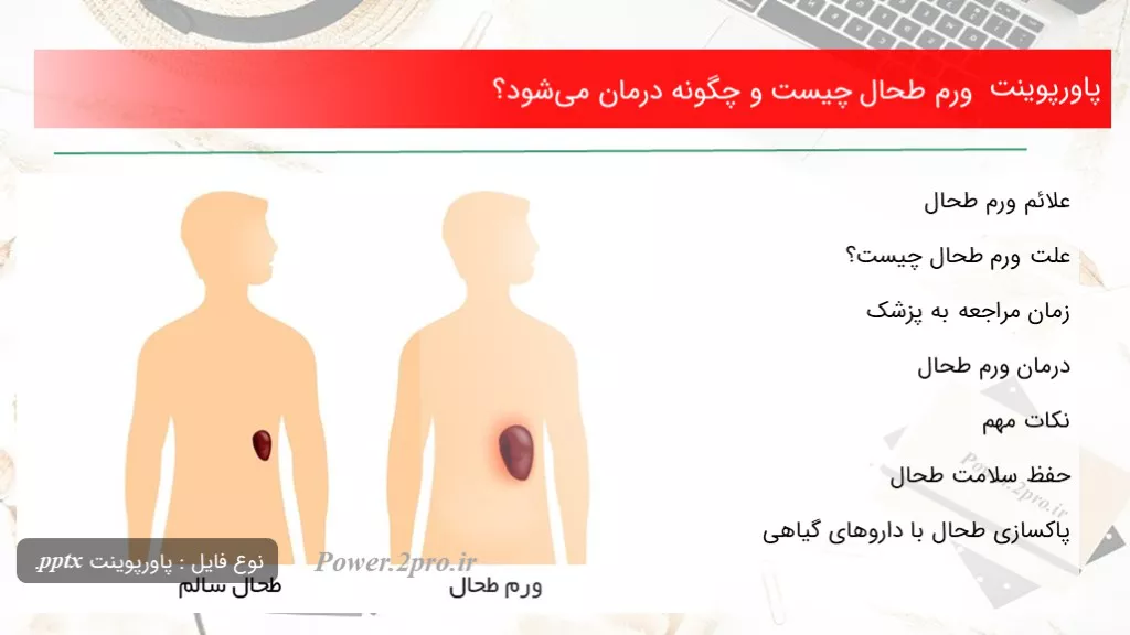 دانلود پاورپوینت ورم طحال چه چیزی است و چطور درمان می‌شود؟ - کد109792