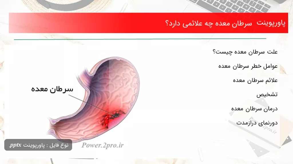 دانلود پاورپوینت سرطان معده چه علائمی دارد؟ - کد109808