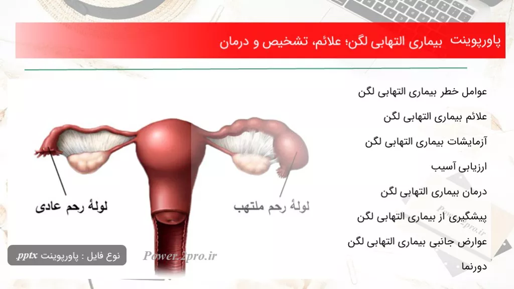 بیماری التهابی لگن؛ علائم، تشخیص و درمان