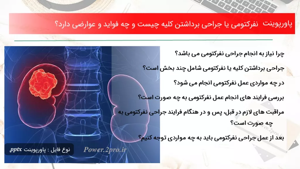 دانلود پاورپوینت نفرکتومی یا جراحی برداشتن کلیه چه چیزی است و چه فواید و عوارضی دارد؟ - کد109821