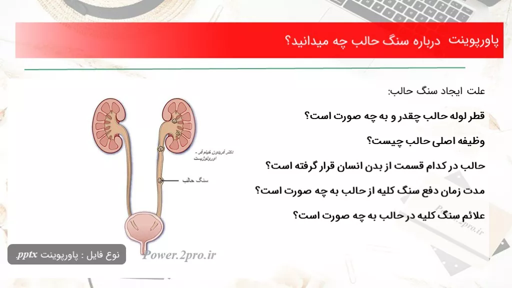 دانلود پاورپوینت درزمینه سنگ حالب چه میدانید؟ - کد109823