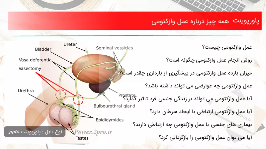 دانلود پاورپوینت همه موارد درزمینه عمل وازکتومی - کد109827