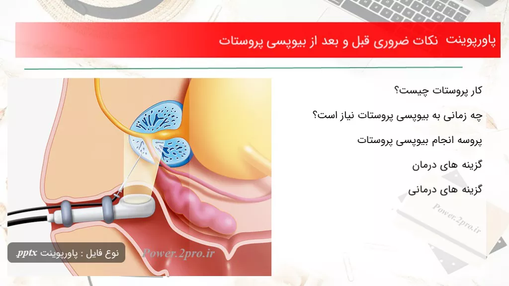 دانلود پاورپوینت نکات ضروری قبل و بعد از بیوپسی پروستات - کد109839