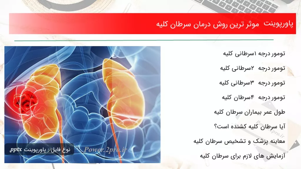 دانلود پاورپوینت موثر ترین چگونگی درمان سرطان کلیه - کد109849