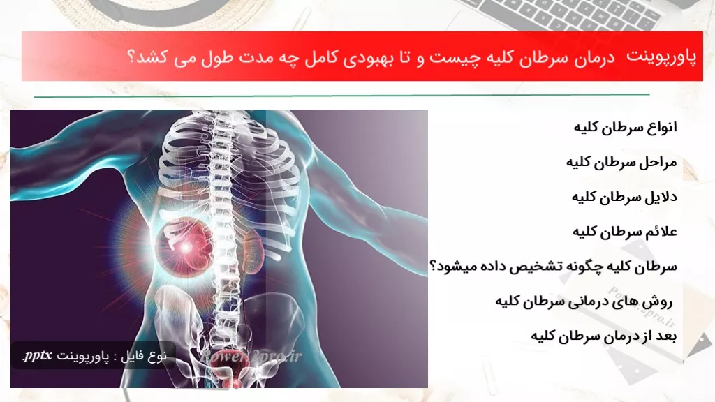 دانلود پاورپوینت درمان سرطان کلیه چه چیزی است و تا بهبودی کامل چه مدت طول می کشد؟ - کد109855