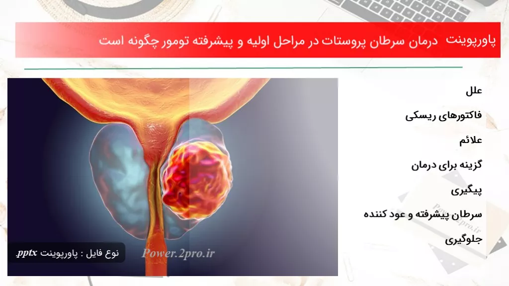 دانلود پاورپوینت درمان سرطان پروستات در مراحل اولیه و پیشرفته تومور چطور است - کد109858