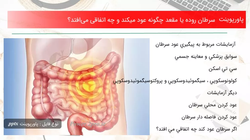 دانلود پاورپوینت سرطان روده يا مقعد چطور عود ميكند و چه اتفاقی می‌افتد؟ - کد109884