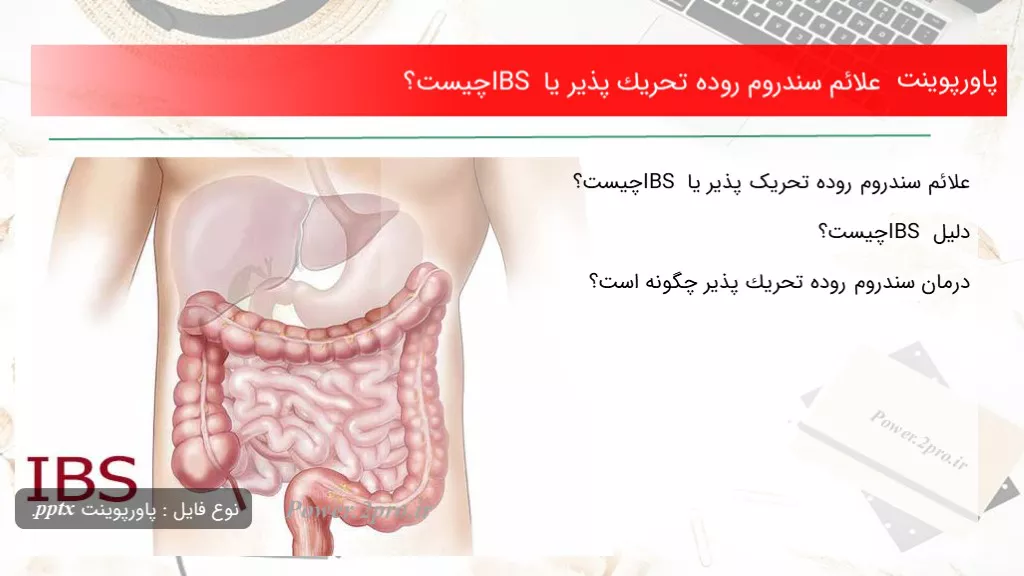 دانلود پاورپوینت علائم سندروم روده‌‌ تحريك پذير یا IBS چه چیزی است ؟ - کد109888