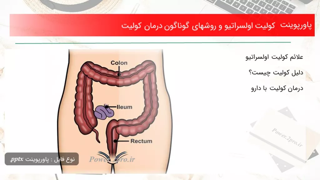 کولیت اولسراتیو و روشهای گوناگون درمان کولیت