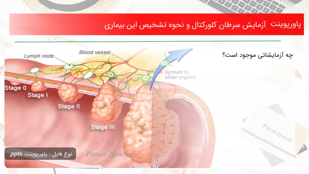 آزمايش سرطان كلوركتال و نحوه تشخیص این بیماری