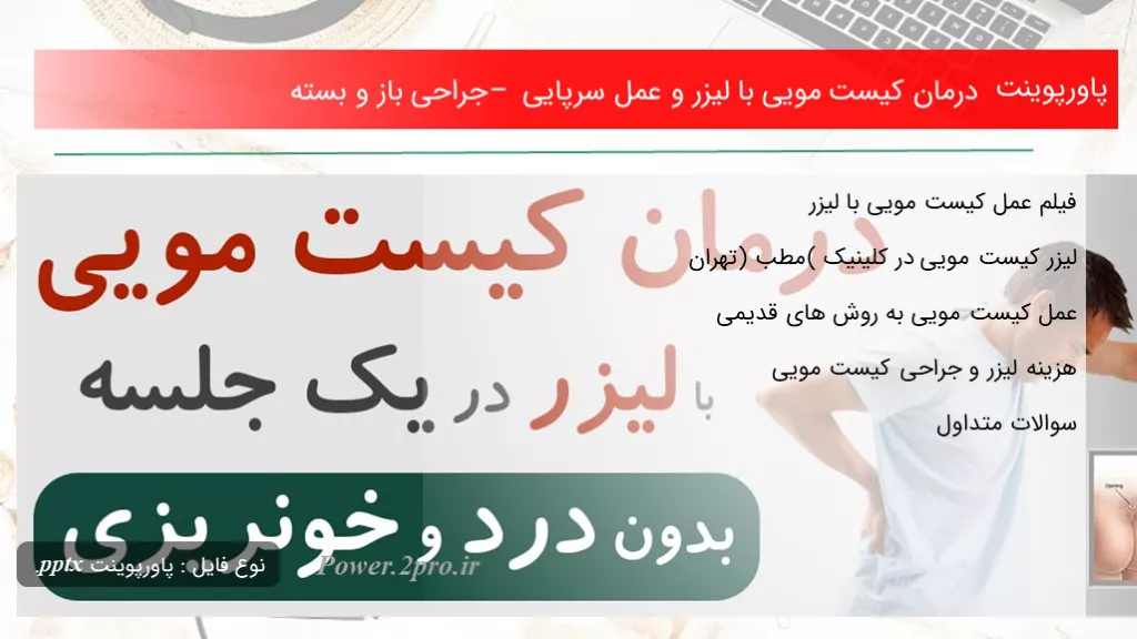 دانلود پاورپوینت درمان کیست مویی با لیزر و عمل سرپایی – جراحی باز و بسته - کد109908