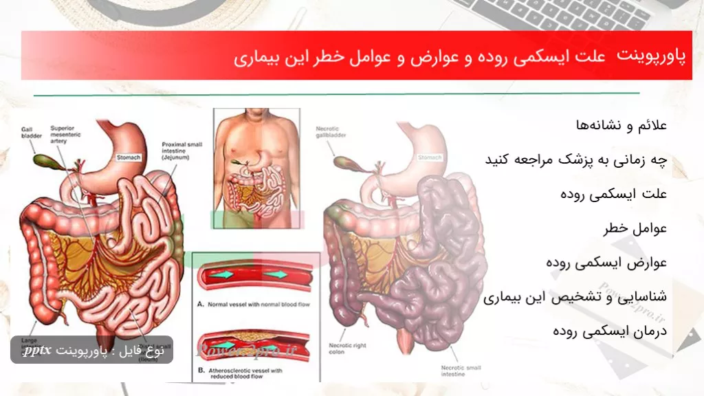 دانلود پاورپوینت چرایی ایسکمی روده و عوارض و عوامل خطر این بیماری - کد109913