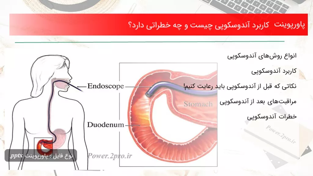 دانلود پاورپوینت استفاده آندوسکوپی چه چیزی است و چه خطراتی دارد؟ - کد109914