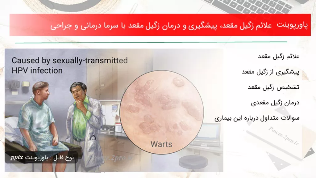 دانلود پاورپوینت علائم زگیل مقعد، پیشگیری و درمان زگیل مقعد با سرما درمانی و جراحی - کد109935