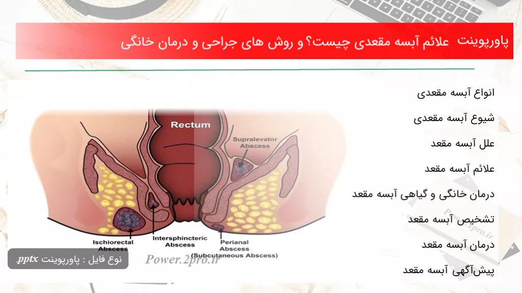 دانلود پاورپوینت علائم آبسه مقعدی چه چیزی است ؟ و چگونگی های جراحی و درمان خانگی - کد109942