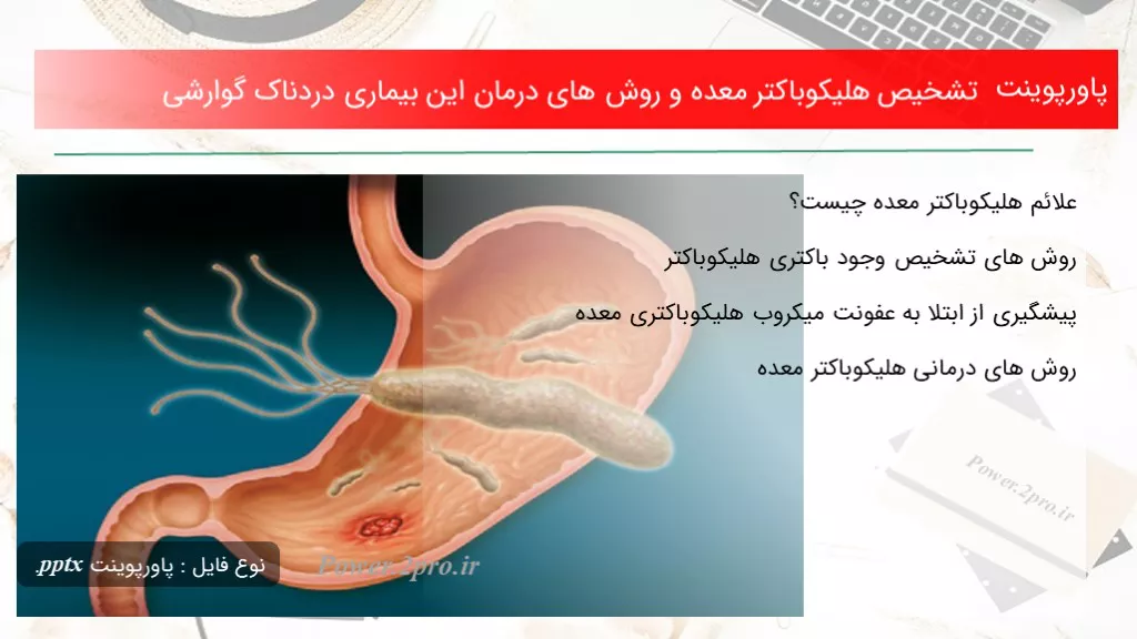 دانلود پاورپوینت تشخیص هلیکوباکتر معده و چگونگی های درمان این بیماری دردناک گوارشی - کد109952