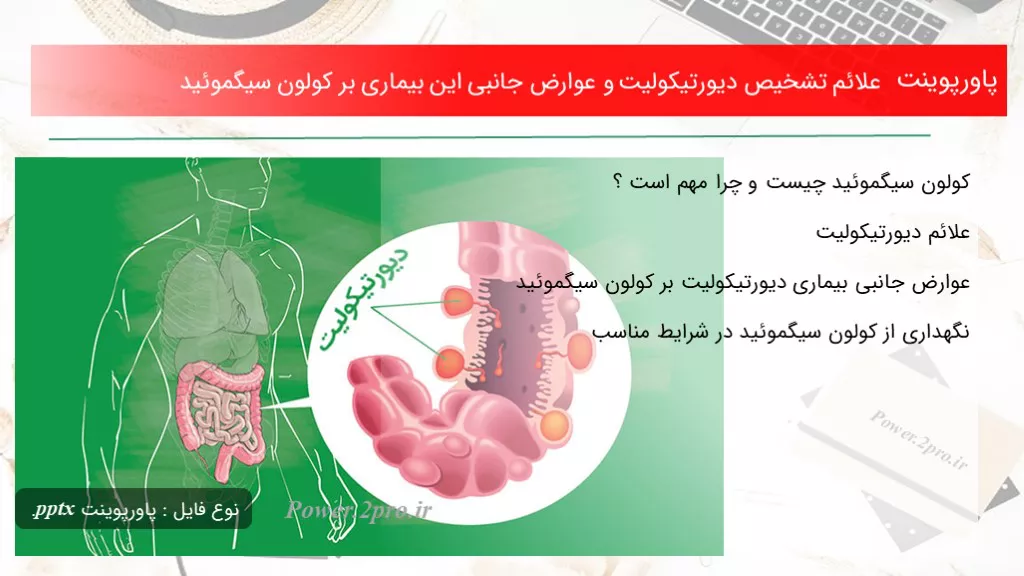 دانلود پاورپوینت علائم تشخیص دیورتیکولیت و عوارض جانبی این بیماری بر کولون سیگموئید - کد109957