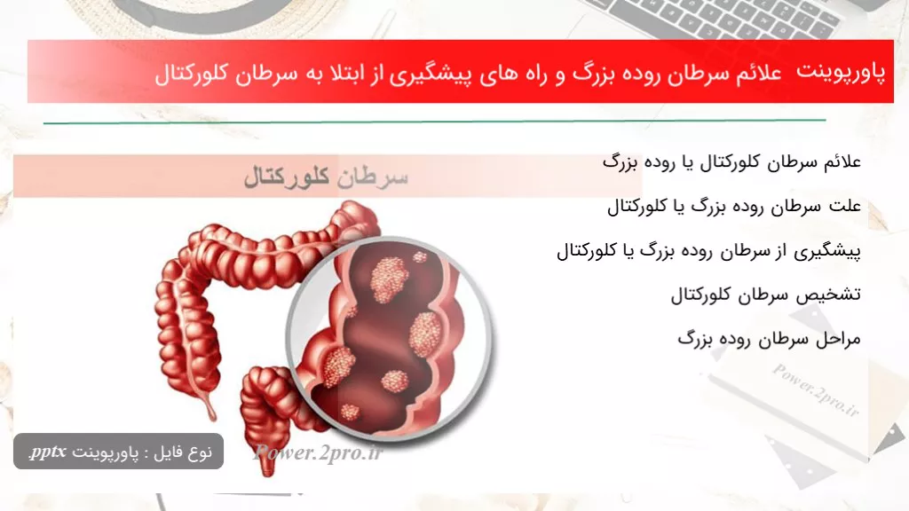 دانلود پاورپوینت علائم سرطان روده بزرگ و راه های پیشگیری از ابتلا به سرطان کلورکتال - کد109962