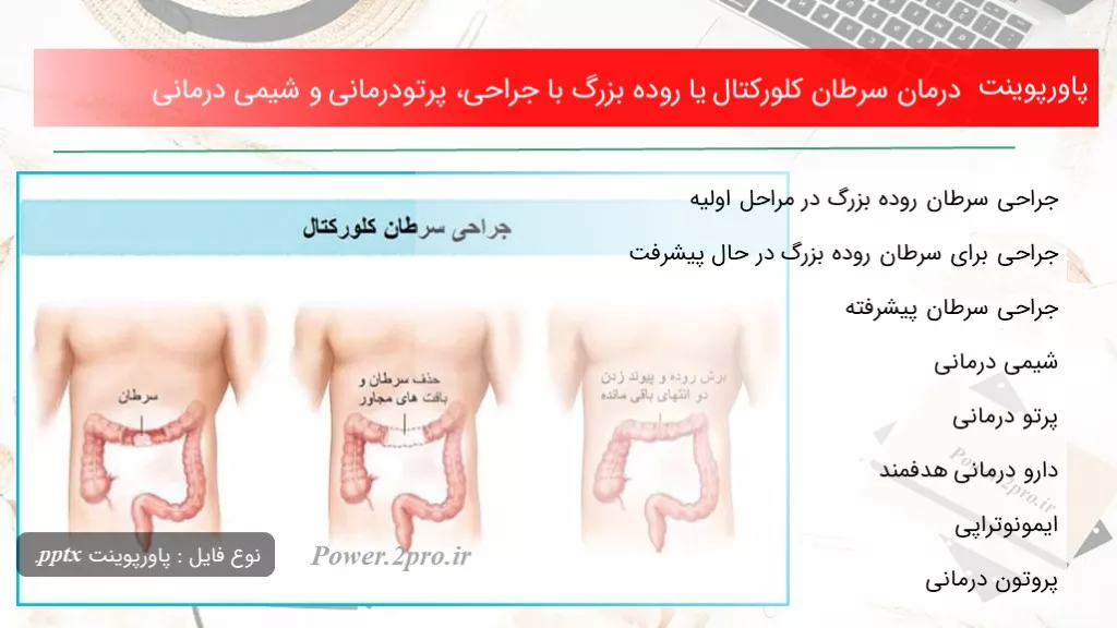 دانلود پاورپوینت درمان سرطان کلورکتال یا روده بزرگ با جراحی، پرتودرمانی و شیمی درمانی - کد109963