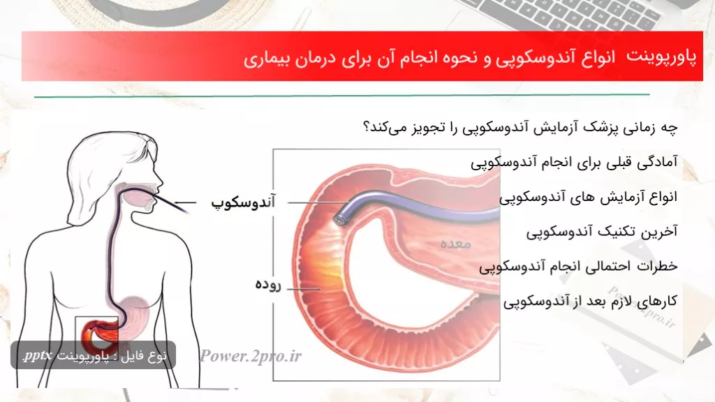 دانلود پاورپوینت انواع آندوسکوپی و نحوه انجام آن به منظور درمان بیماری - کد109967