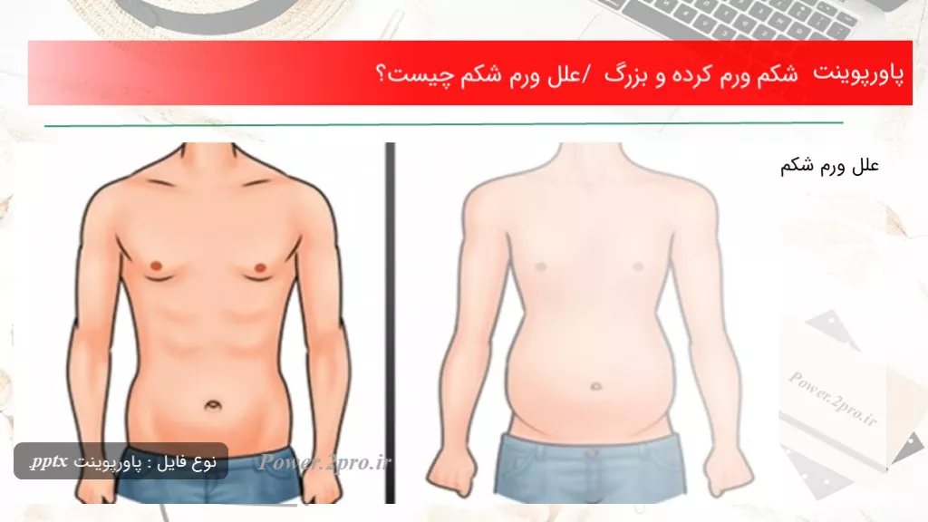 دانلود پاورپوینت شکم ورم کرده و بزرگ / علل ورم شکم چه چیزی است ؟ - کد110632