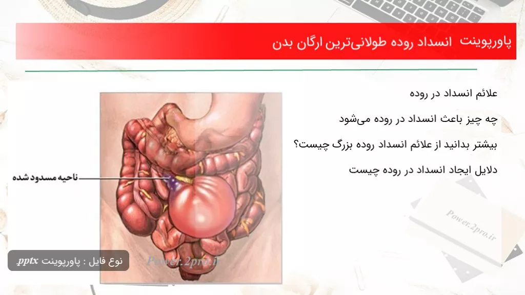 دانلود پاورپوینت انسداد روده طولانی‌ترین ارگان بدن - کد110708