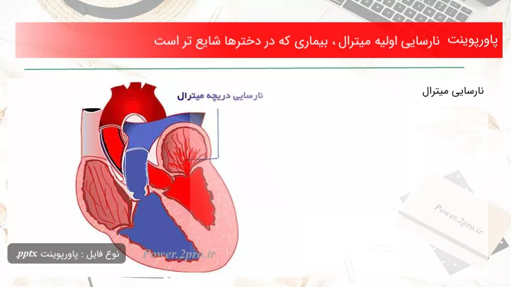 دانلود پاورپوینت نارسایی اولیه میترال ، بیماری که در دخترها شایع تر است - کد110741