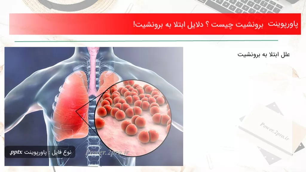 دانلود پاورپوینت برونشیت چه چیزی است ؟ دلایل ابتلا به برونشیت! - کد110802