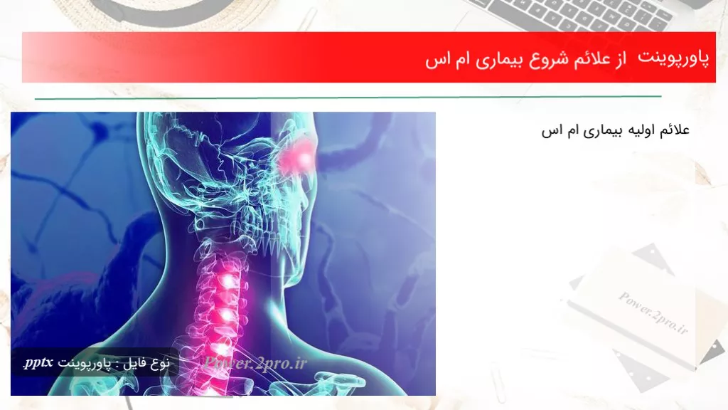 دانلود پاورپوینت از علائم مقدمه بیماری ام اس - کد110815